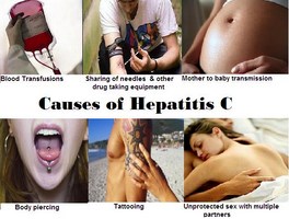 Causes of hep C